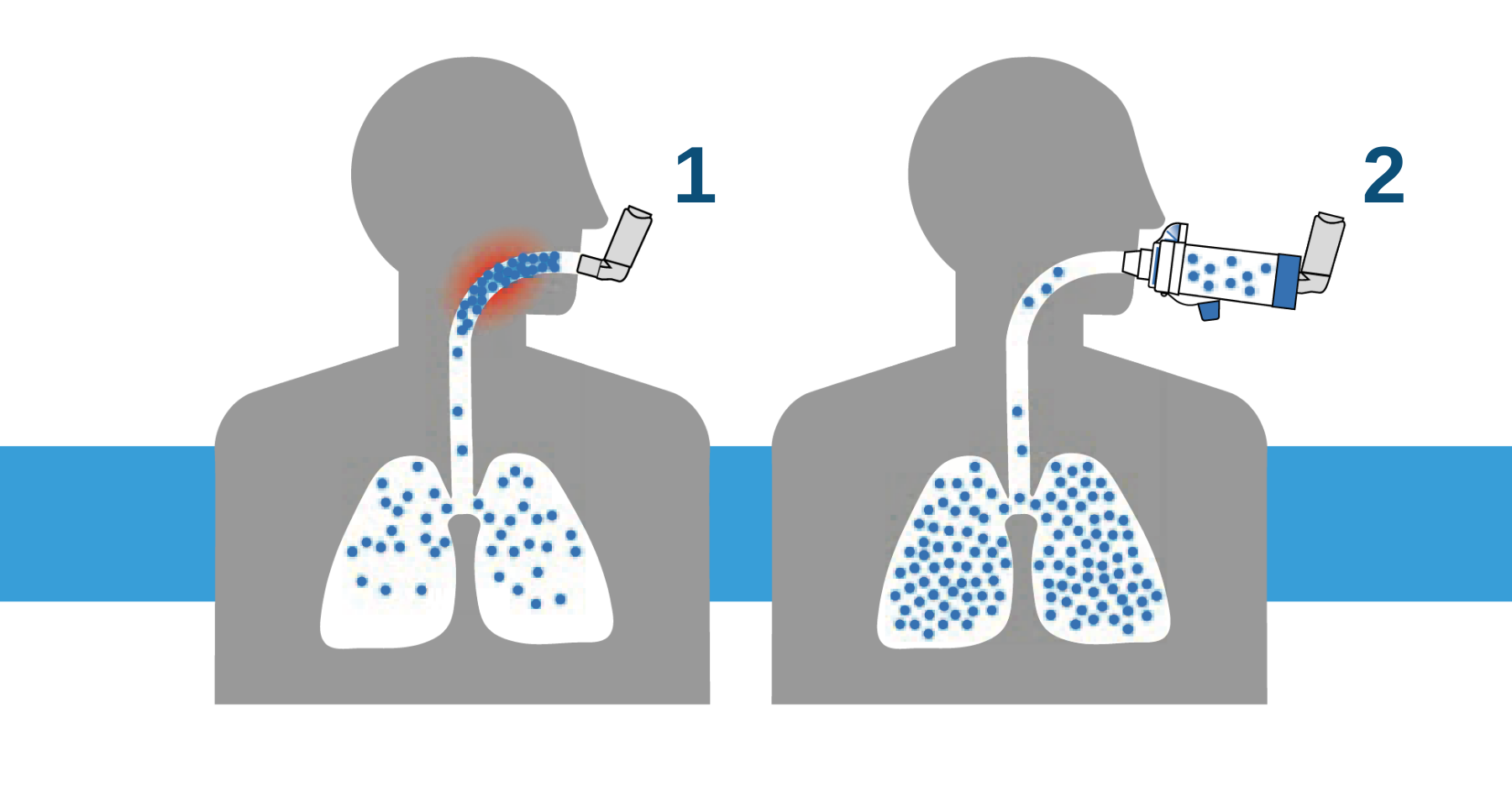 AEROCHAMBER PLUS® FLOW-VU® AVHC - Monaghan Medical